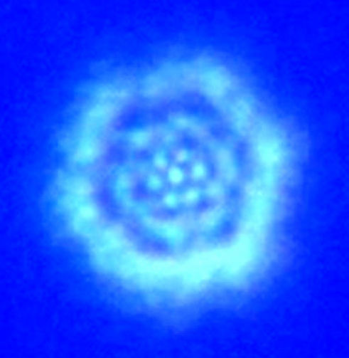 Highly Complex Structured Water: Regeneroactive Biophoton Excelex Somatoscope Image