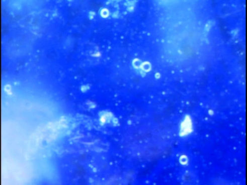Zero Structured Water: Degeneroactive Biophotons Excelex Somatoscope Image