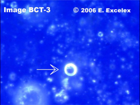 Large Degeneroactive Biophoton in three-month old cucumber