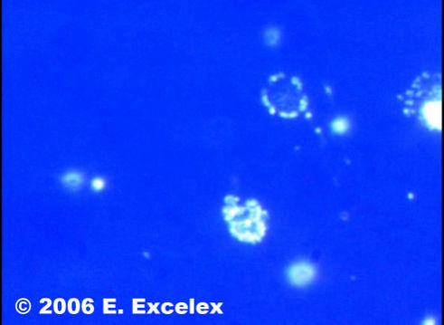 Somatoscope image of Reverse Osmosis Water with no biophotons
